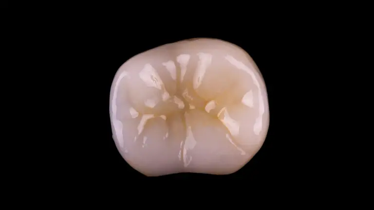 Coroa cerâmica posterior em vista oclusal, fotografada em estúdio sobre fundo preto